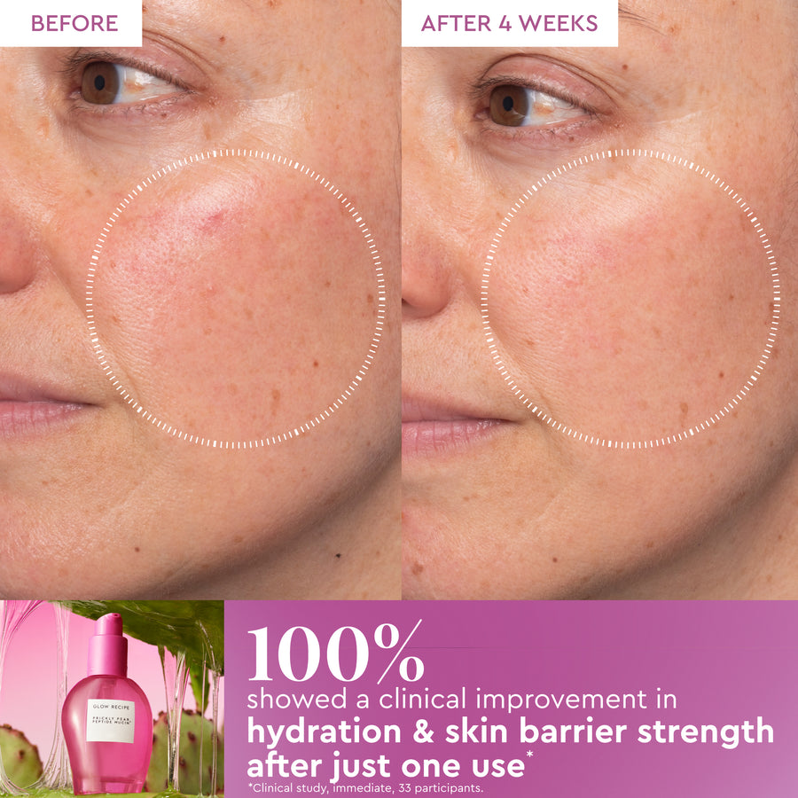 kaktusfeigen-peptid-mucin