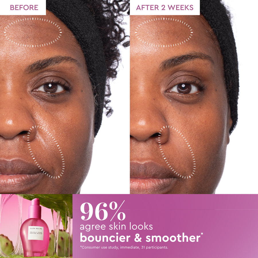 kaktusfeigen-peptid-mucin