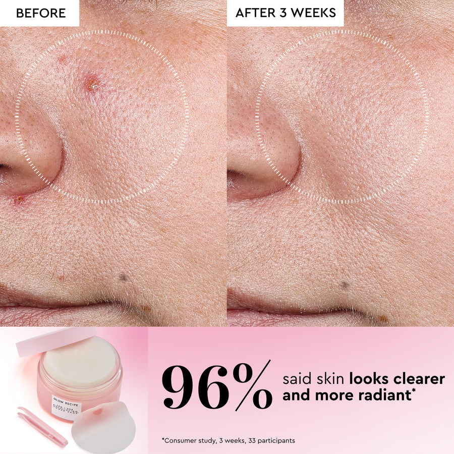 lha aha koreanische wassermelonen-toner-pads